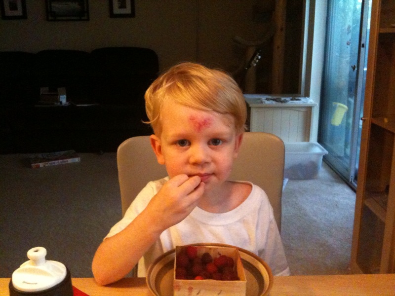 Owens boo boo This photo is from back in June when Owen fell down the cement stairs leading out of our apartment. He had quite the egg on his forhead for awhile.