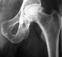 Medical Malpractice Defective Products