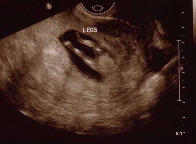 [ultrasound4.jpg]