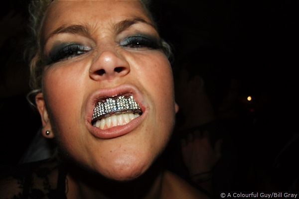 Model Bex Coddington wearing grillz.