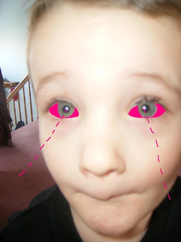 [pinkeye 2[3].jpg]