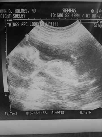 [baby boy weight[8].jpg]