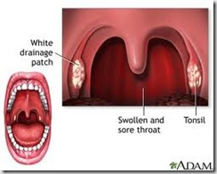 mouth-bacteria