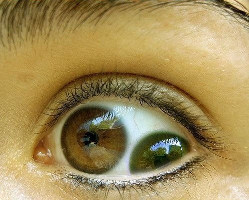 [bizarre-eyes2[2].jpg]