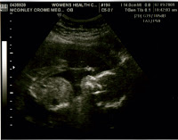 baby1.jpg