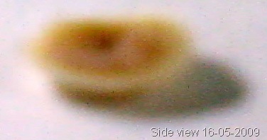 [2009-05-16 - toeCornPeelOff (showThickness)[13].jpg]