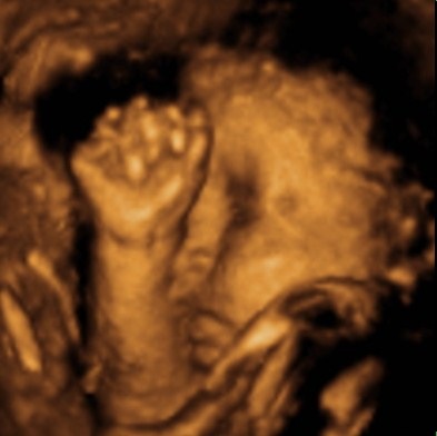 [isabellababy[2].jpg]