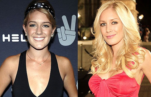 heidi montag before and after. Heidi Montag Before And After