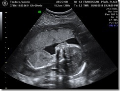 BABY_6 BABY_6