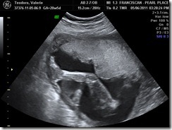 BABY_7 BABY_7