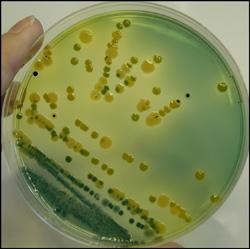 [Vibrio Cholera[2].jpg]