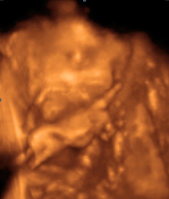 [UC BABY2_25[4].jpg]