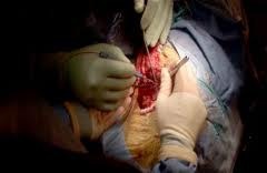 surgery