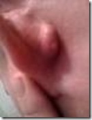 ear1
