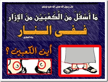 ما أسفل من الكعبين من الإزار ففي النار 