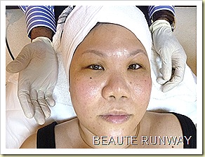 HealthTrends eCo2 Laser Treatment After