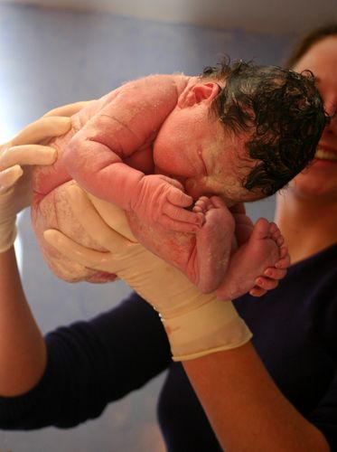 vernix caseosa