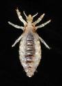 body louse