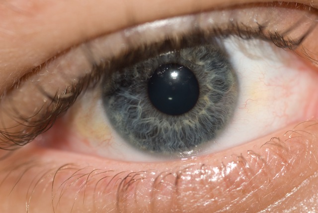 [Eye (8 of 8)[3].jpg]