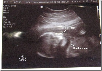 ultrasound2