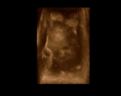 [baby nephew[5].jpg]
