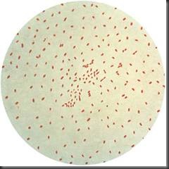 BORDETELLA PERTUSSIS ~ BAHAN KULIAH DAN MAKALAH KESEHATAN BORDETELLA PERTUSSIS ~ BAHAN KULIAH DAN MAKALAH KESEHATAN