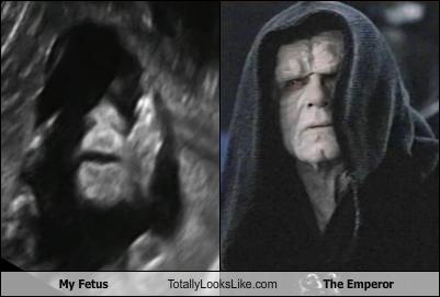 [my-fetus-totally-looks-like-the-emperor[4].jpg]