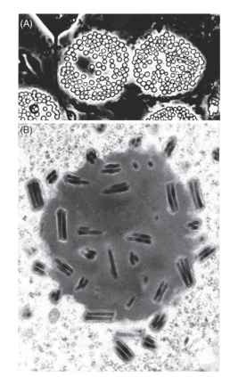 Nuclear polyhedrosis virus polyhedra. (A) Wet mount preparation viewed with phase microscopy showing refractile poly-hedra in two infected nuclei. (B) Transmission electron micrograph through a single polyhedron showing the enveloped rod-shaped viri-ons, characteristic of NPVs, occluded within the polyhPathogens of Insectsedral matrix. Upon ingestion, this matrix dissolves in the insect midgut, and the virions invade the host through midgut microvilli.