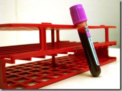 blood test - PSA blood test - PSA
