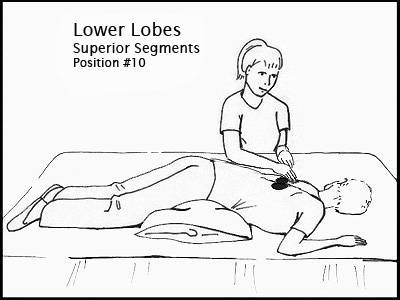[PD-10-LowerLobes_Superior_Segments[3].jpg]