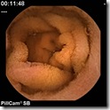 small_bowel_2 small_bowel_2