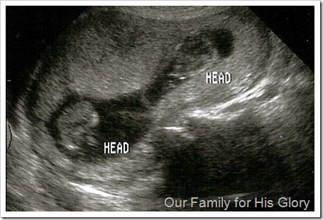 ultrasound of twins
