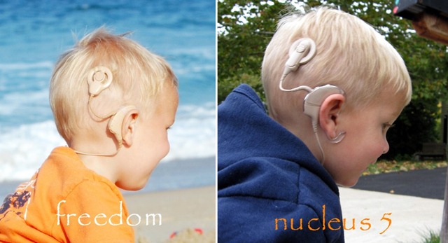 [cochlear processors side by side[1].jpg]