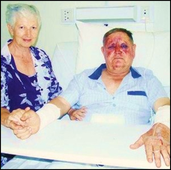 Engelbrecht Charles and Violent attacked Magogong Hartswater NW Jan102010 Jane Engelbrecht Volksblad pic Engelbrecht Charles and Violent attacked Magogong Hartswater NW Jan102010 Jane Engelbrecht Volksblad pic