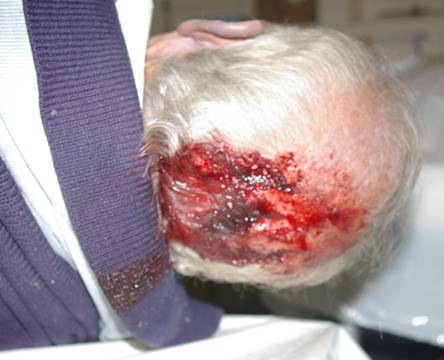 [Alzheimer sufferer James Brown[13].jpg]