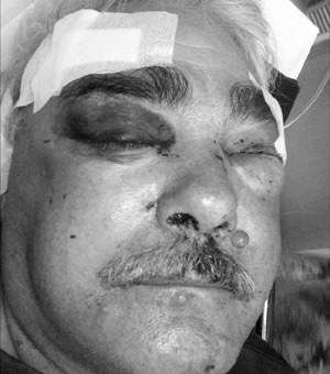 [Diedericks Thys Pietersburg Limpopo Tractors businessman Attacked[4].jpg]