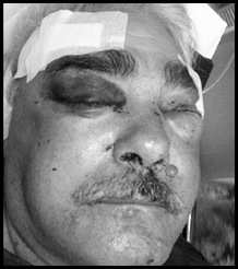 Diedericks Thys Pietersburg Limpopo Tractors businessman Attacked
