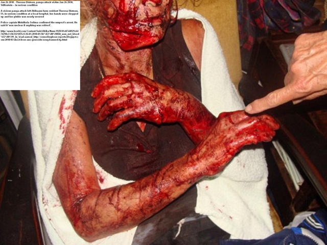 [Theresa Eksteen panga attack survivor Jan262010 Stilfontein farm 51 serious condition[5].jpg]