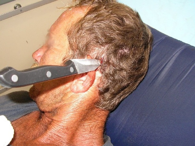 [KnifeInHead_TraumaSocietyOfSouthAfrica_VictimPic[4].jpg]