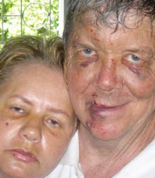 [Dion and Talita Röder Ladysmith_BeatenUpByArmedGang[5].jpg]