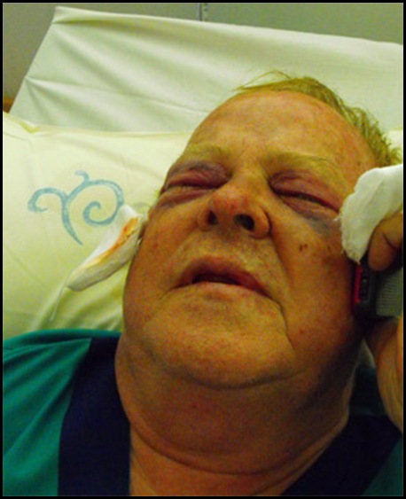 Pretorius Marius top SA eye surgeon attackers tried to gouge out his eyes Vereeniging 20091206 Pretorius Marius top SA eye surgeon attackers tried to gouge out his eyes Vereeniging 20091206