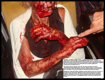 Eksteen Theresa panga attack victim Vermaansdrift Viljoenskroon AH Jan 25 2010