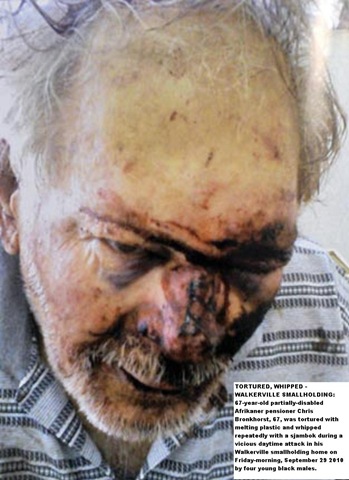 [Bronkhorst Chris disabled Walkerville man tortured melt plastic and sjambok Sept292010 4 blacks[5].jpg]