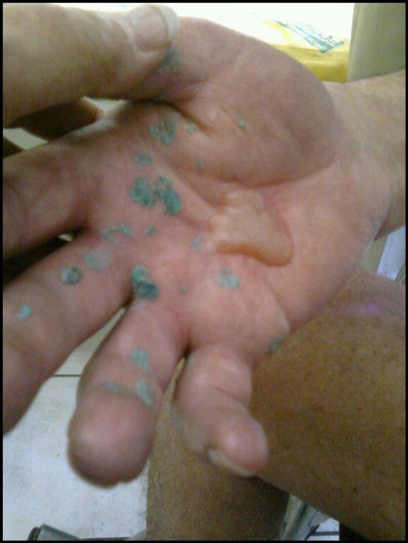 TORTURE during SA violent crime white victims often burnt with melting plastic