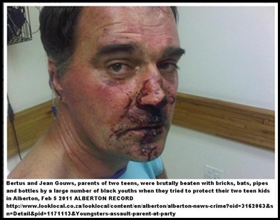 Gouws Berthus brutally beaten by black youths ALBERTON Feb112011 Gouws Berthus brutally beaten by black youths ALBERTON Feb112011