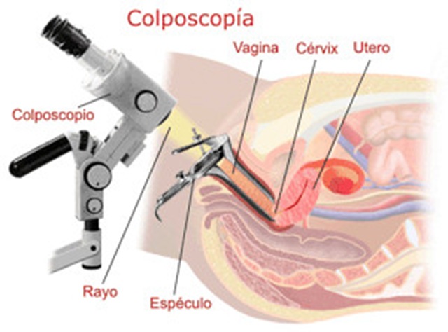 [colposcopia2[1].jpg]