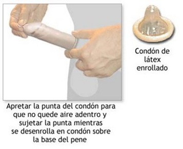 condon1yg3