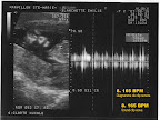 echo15aout_08.jpg