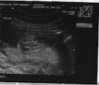 C'est une fille / It's a girl