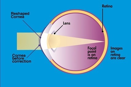The Emmetropic Eye